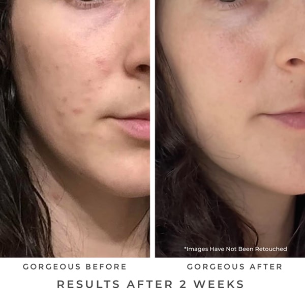 Oasis-Deep-Pore-Gel-Cleanser-earth-harbor-results
