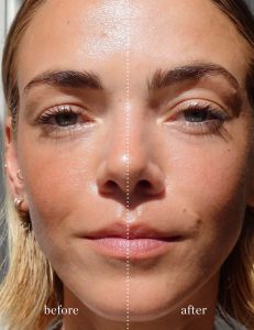Green-Tea-Oil-Control-Paper-ere-perez-before-after